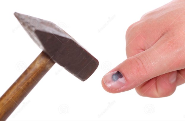 il-martello-ed-il-dito-con-il-nero-hanno-battuto-l-unghia-su-fondo-bianco-42398492